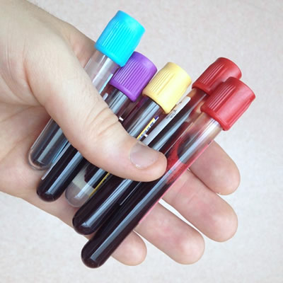 blood-vials blood-vials