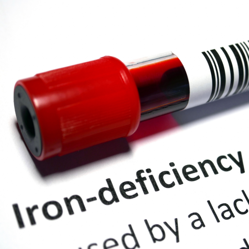 Living with iron deficiency